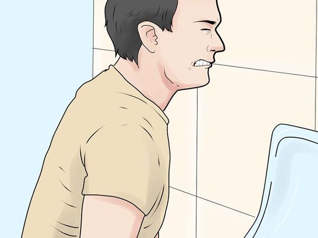 Pain when urinating is a symptom of exacerbation of prostatitis in men