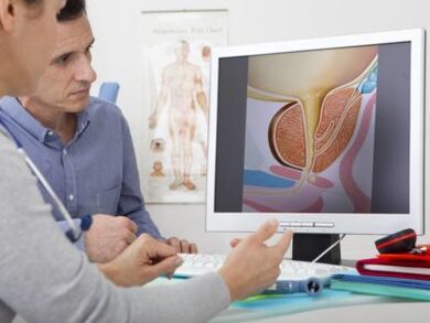 A urologist consults a patient about prostatitis and treatment methods.