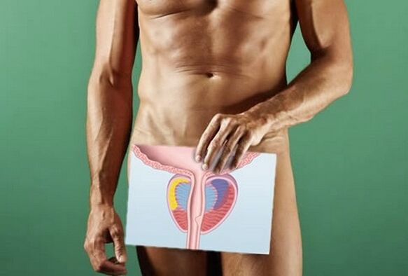 A man suffering from prostatitis